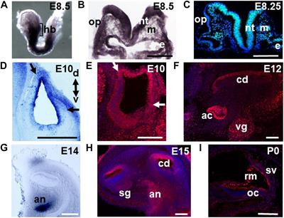 Meis2 Is Required for Inner Ear Formation and Proper Morphogenesis of the Cochlea